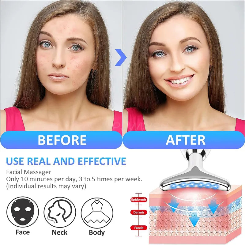 3-Color  Facial Massage Device - HejK.com Marketplace LLC