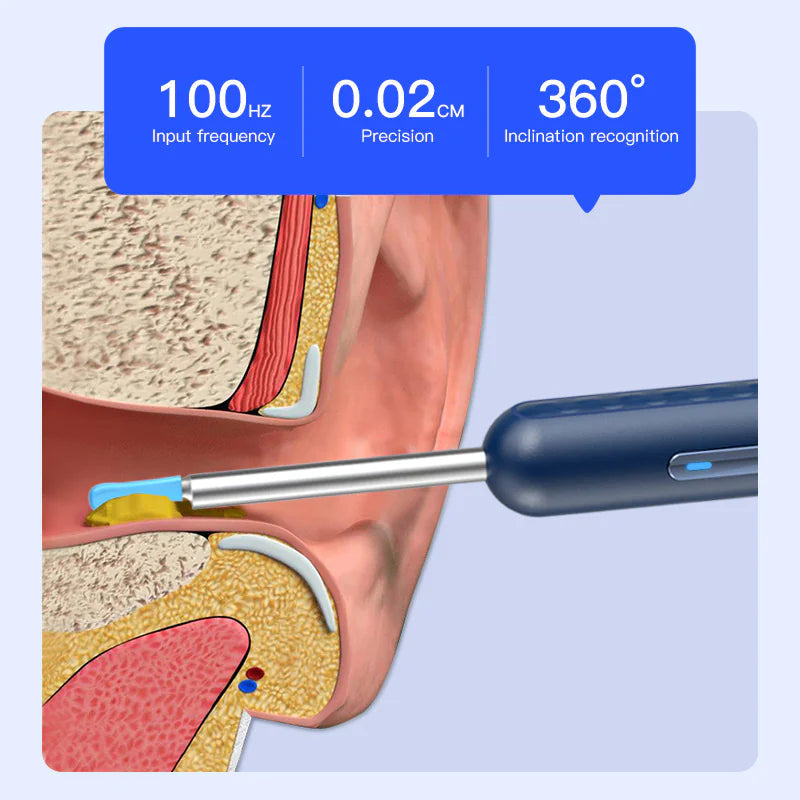 Visual Earpick Endoscope Smart Ear Picking Tools WiFi WEM Support (www.WEM.support)