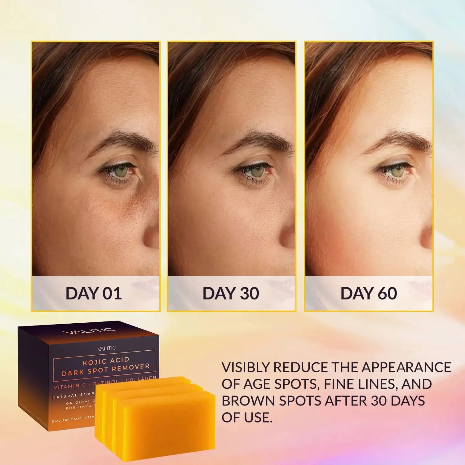 Valitic Unisex Dark Spot Corrector Bar, 100g - Exfoliating, SLS and Paraben-Free Turmeric Soap for Skin Tone Correction, Vitamin C, Retinol and Collagen Blend 3 Pack + Bag My Store