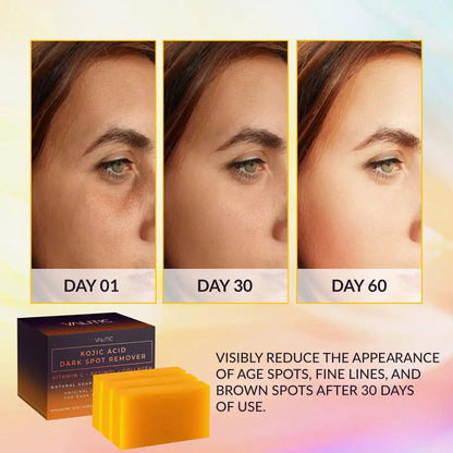 Valitic Unisex Dark Spot Corrector Bar, 100g - Exfoliating, SLS and Paraben-Free Turmeric Soap for Skin Tone Correction, Vitamin C, Retinol and Collagen Blend 3 Pack + Bag My Store