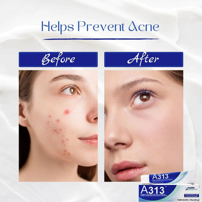 A313 Retinol Pommade Anti Aging Night Cream , The pore cleansing skin cream a313 My Store